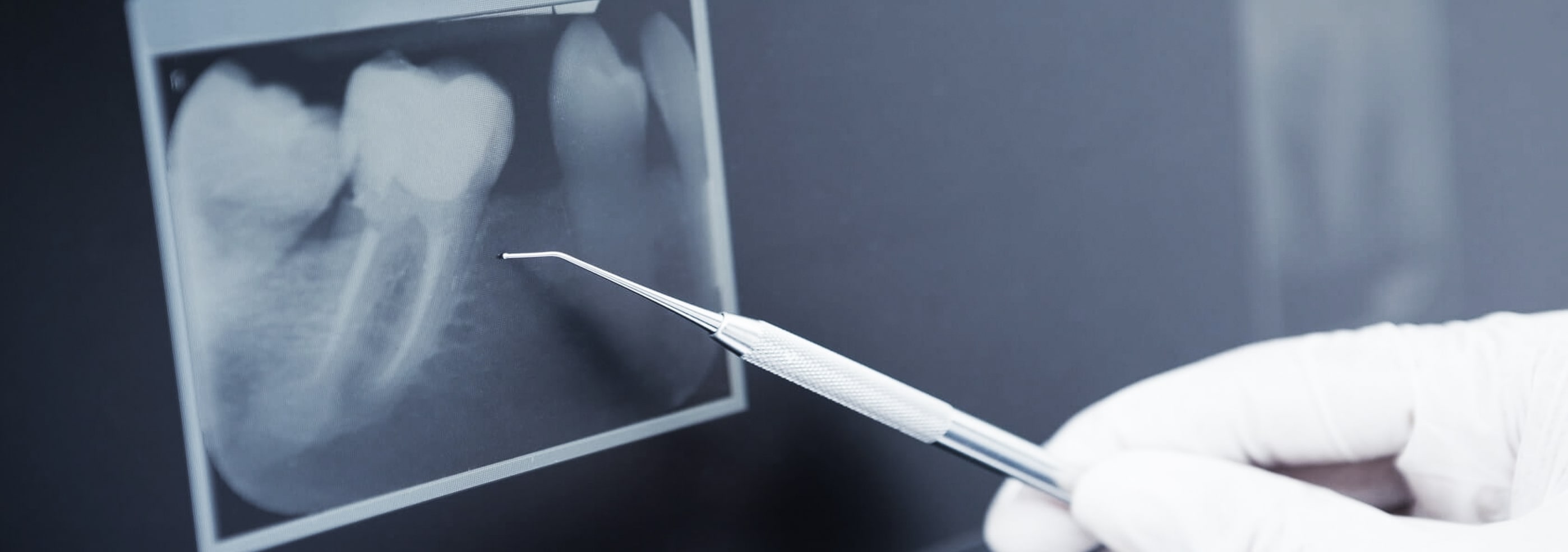 Illustration de radiographie dentaire - Cabinet dentaire Rocher